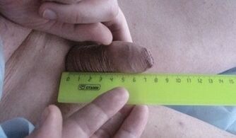 Miessung vun der Gréisst vum Penis